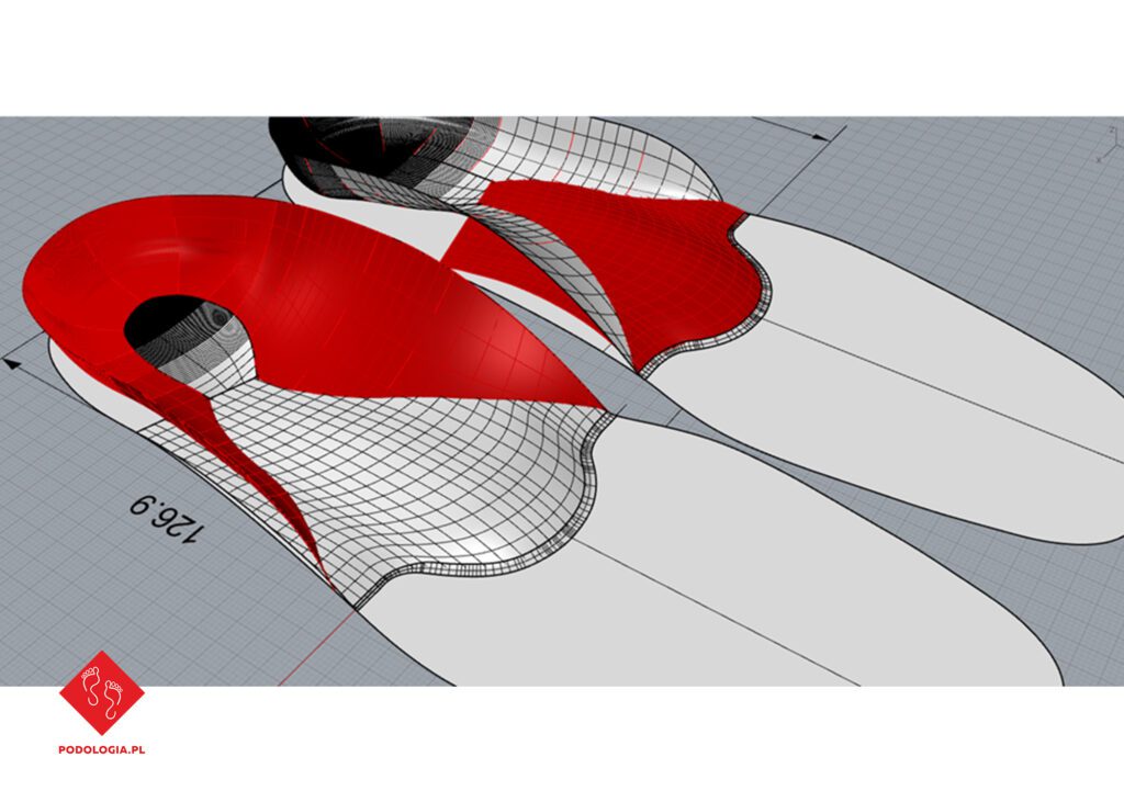 wkładki ortopedyczne